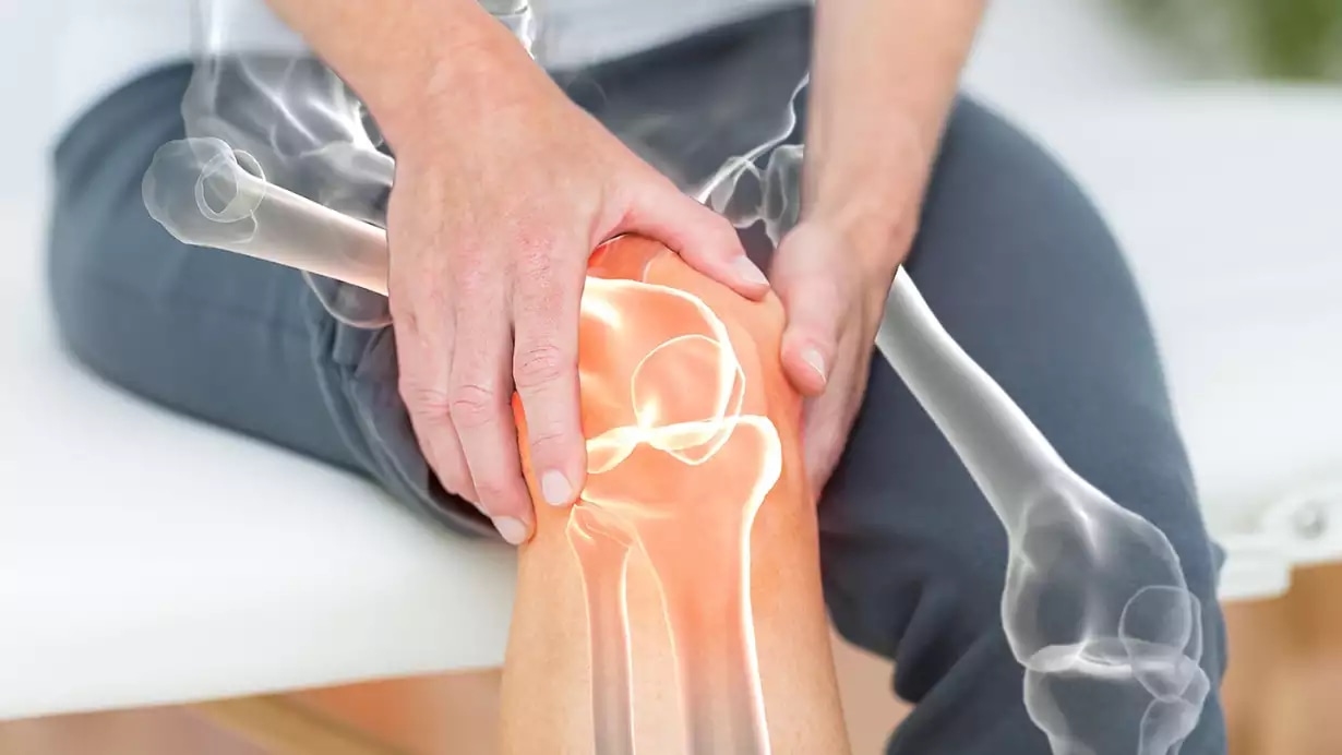 Knieschmerzen vorbeugen: So beeinflussen deine Gewohnheiten dein Knie