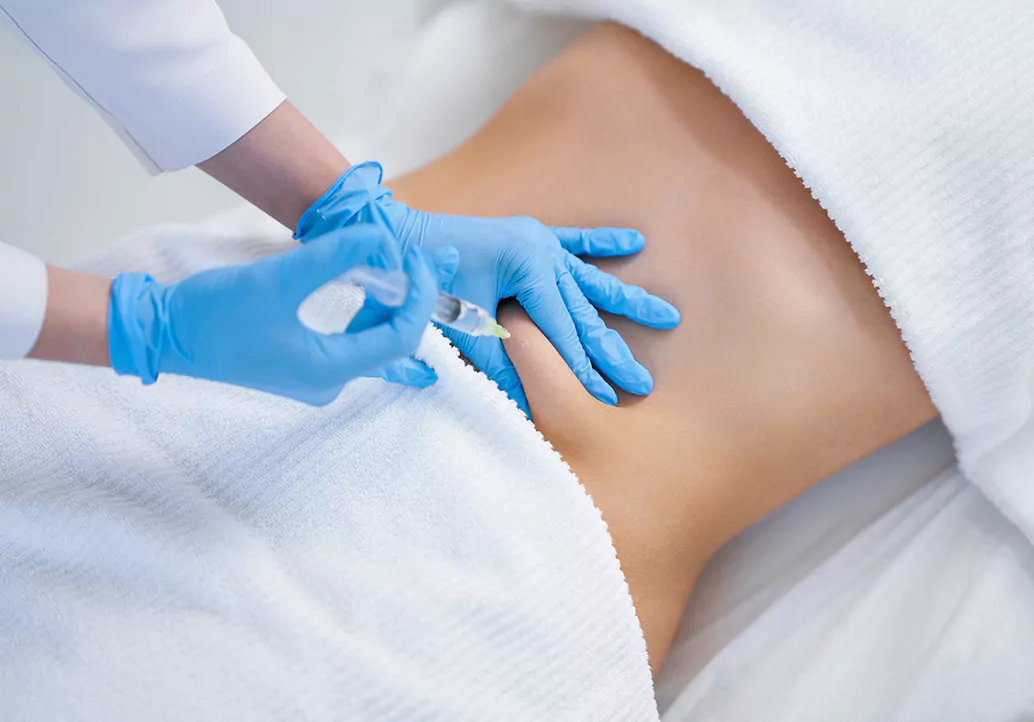 Einfach bestellen: lipolyse spritze kaufen bei MorySkin